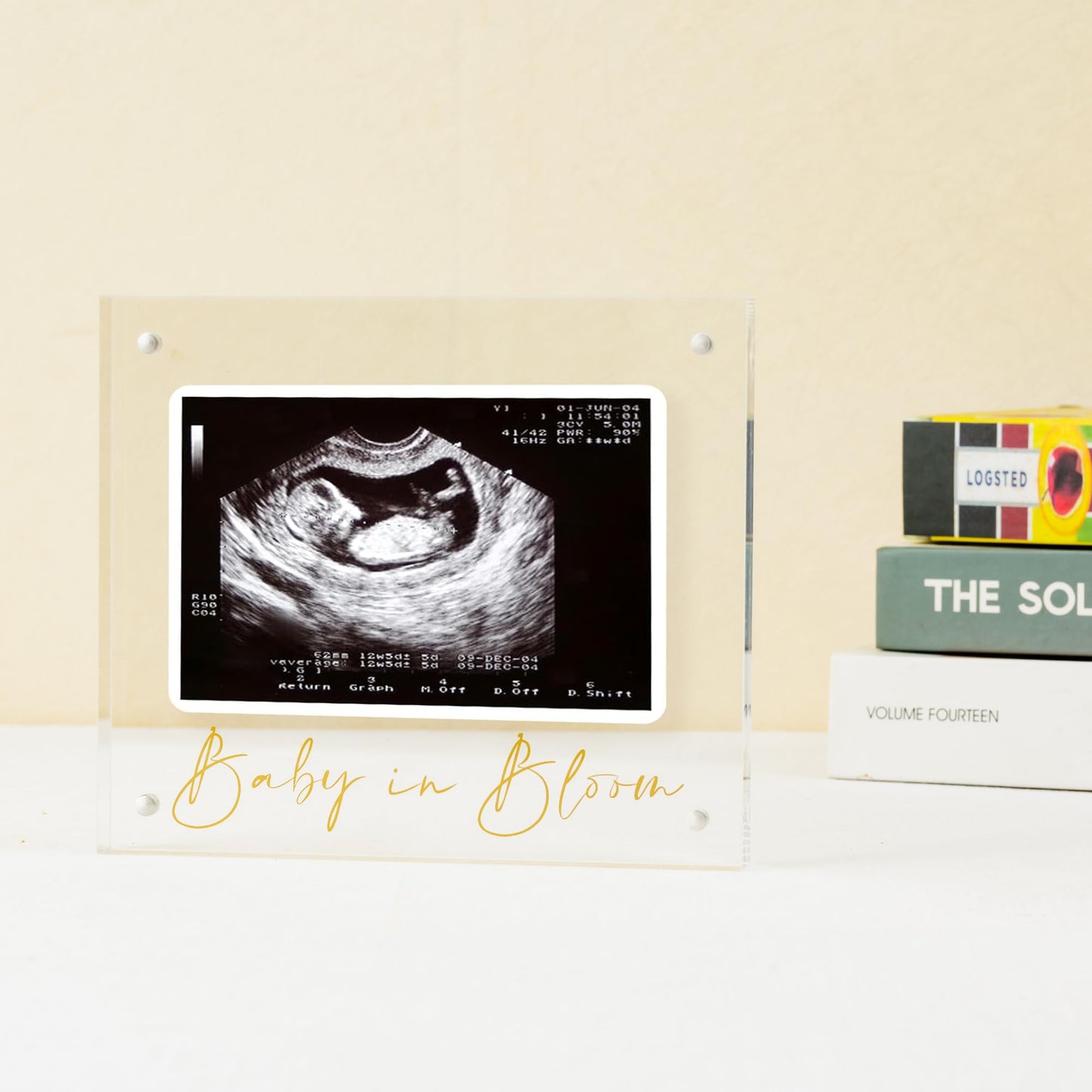 Calculs Baby US Frame Baby in Bloom Ultrasound Sonogram Keepsake Acrylic Picture Frame Freestanding Double Sided Magnetic Lucite Frameless Display Gifts