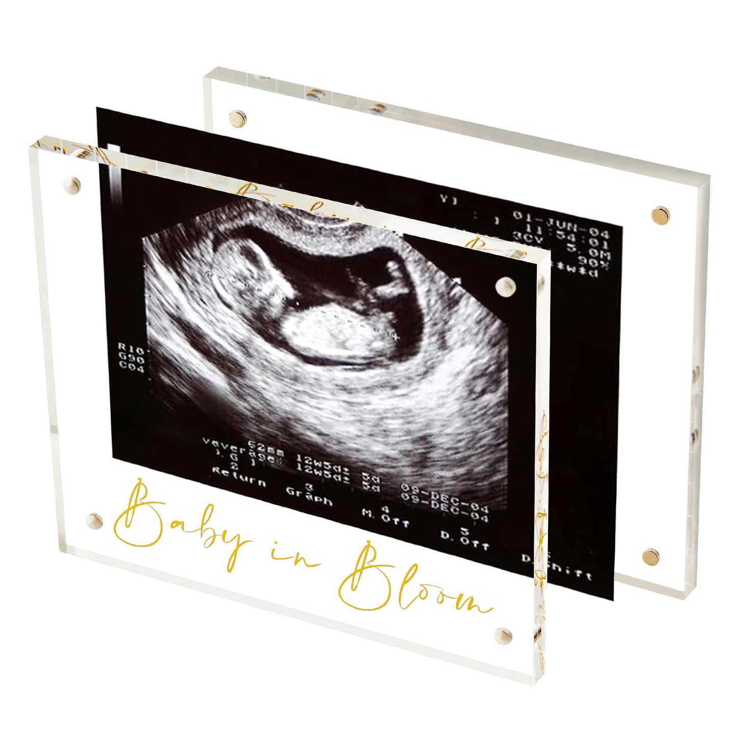 Calculs Baby US Frame Baby in Bloom Ultrasound Sonogram Keepsake Acrylic Picture Frame Freestanding Double Sided Magnetic Lucite Frameless Display Gifts
